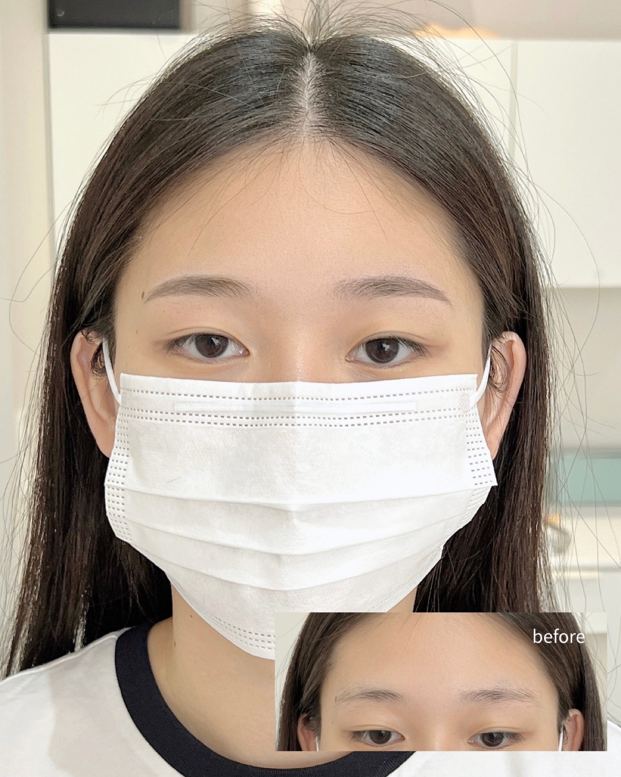 정면에서 본 눈썹 전후 인상 변화
